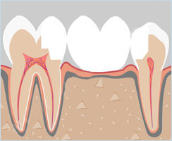 Мост с опорой на вкладки