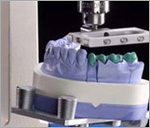 имплантация и лечение зубов - коронки керамические