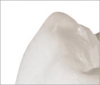 керамические коронки CERCON