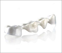 керамические коронки на оксиде циркония