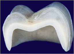 коронки PROCERA